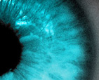 Eye of Embessa